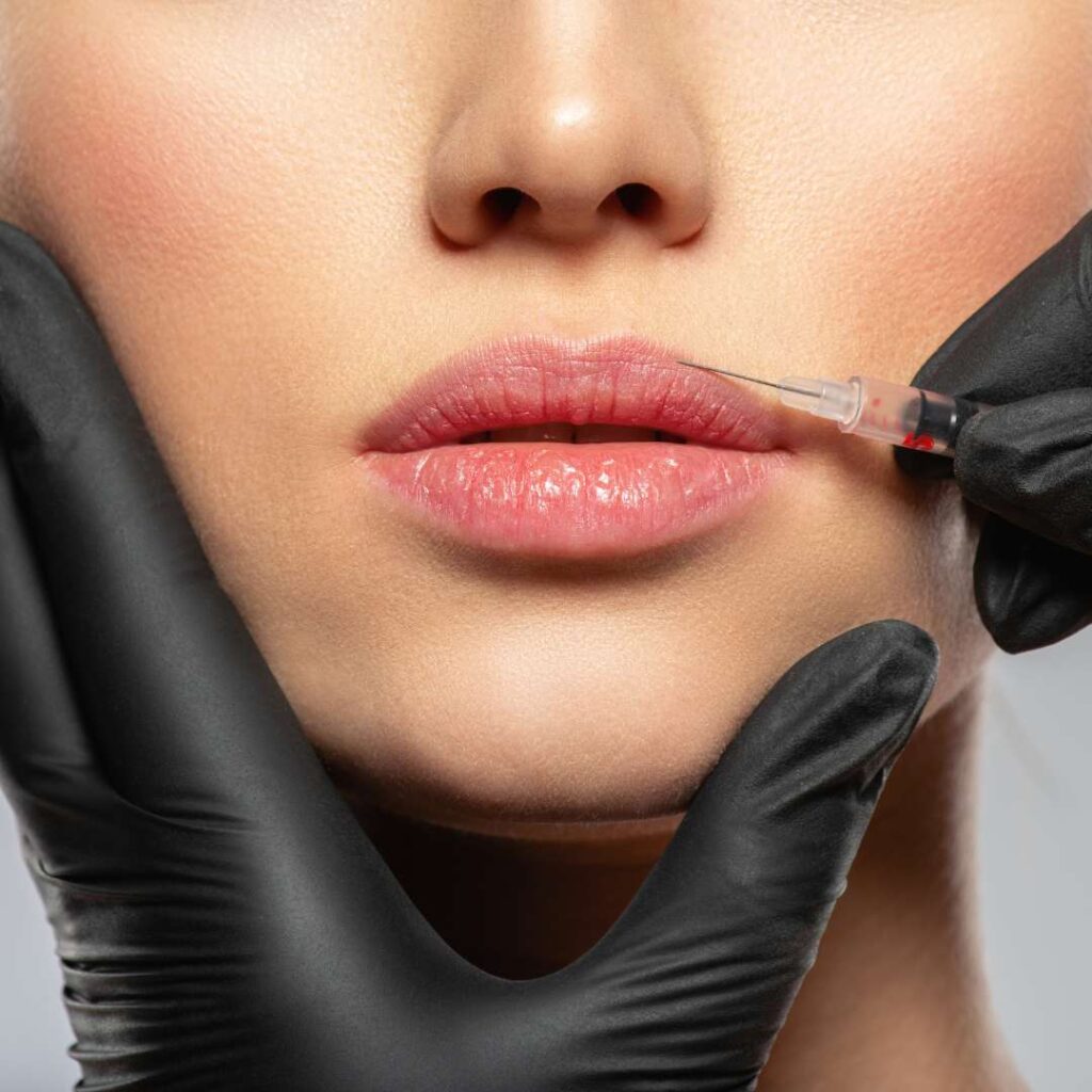 Topire acid hialuronic